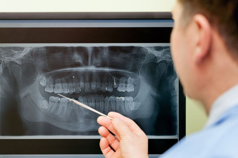 Dentist reviewing dental X-rays on medical screen.
