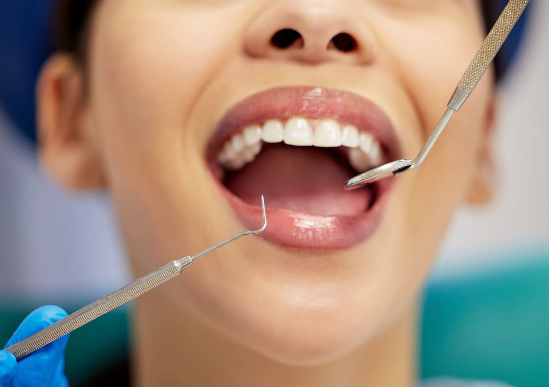 Patient undergoing dental treatment with several dental instruments surrounding her mouth.