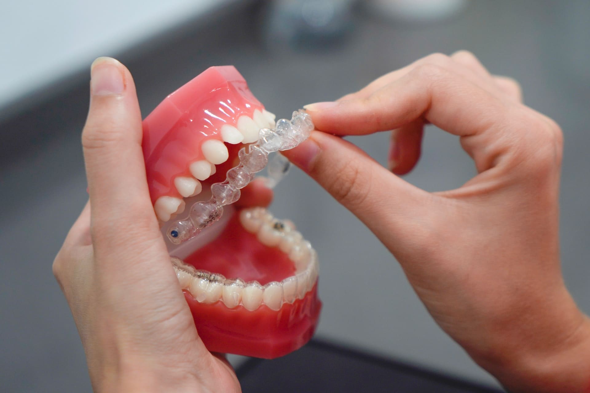 Invisalign aligners being placed on a set of fake teeth.
